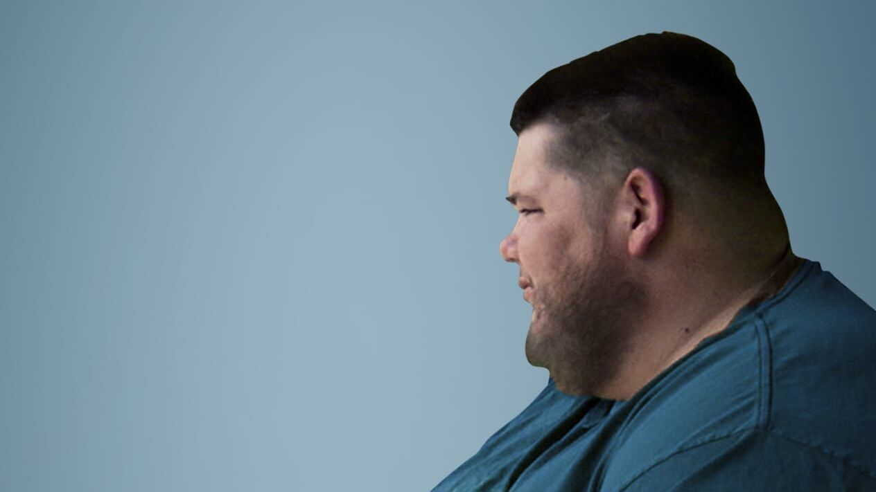 Mein Leben mit 300 kg