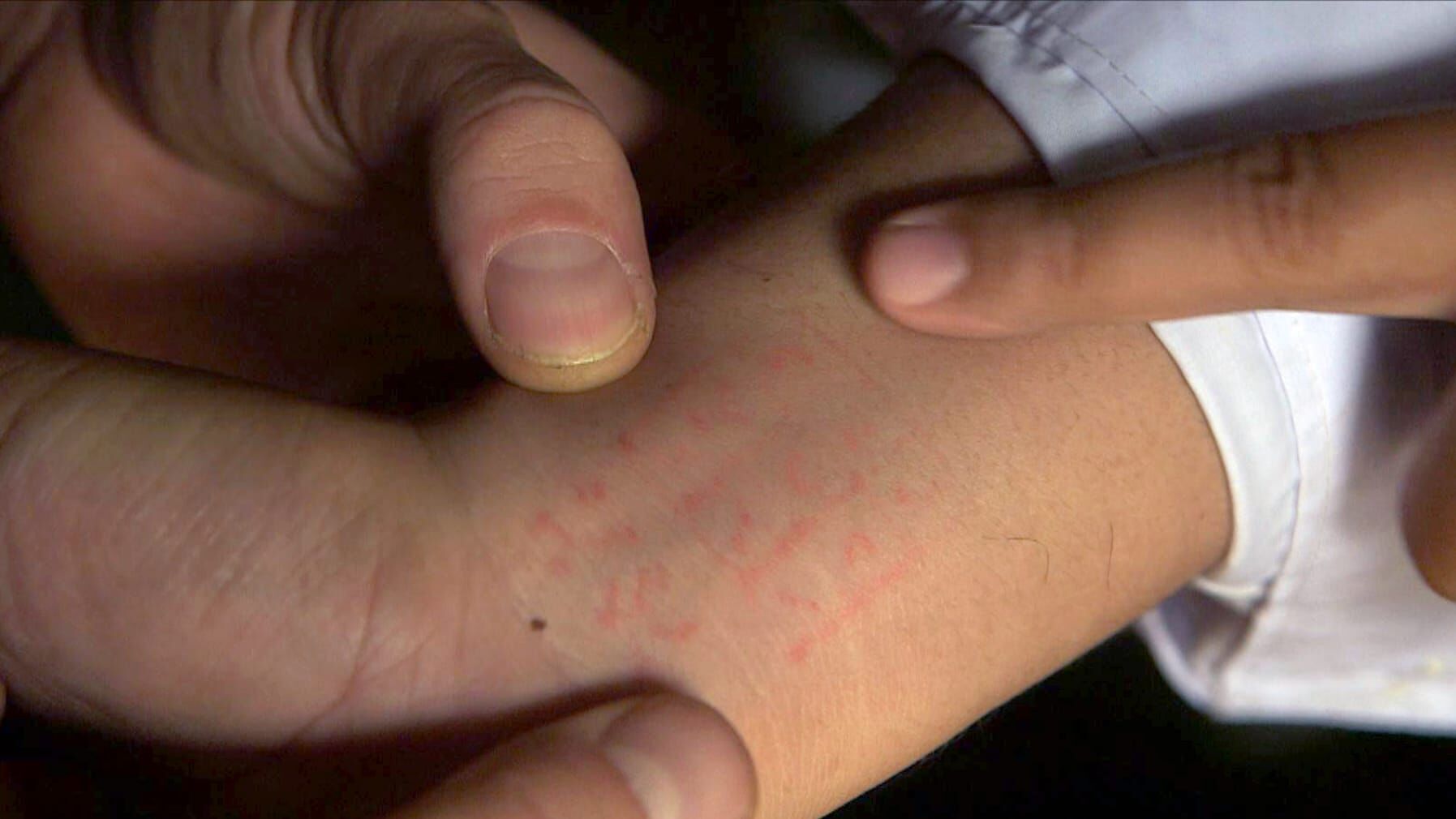 Medizin in fernen Ländern