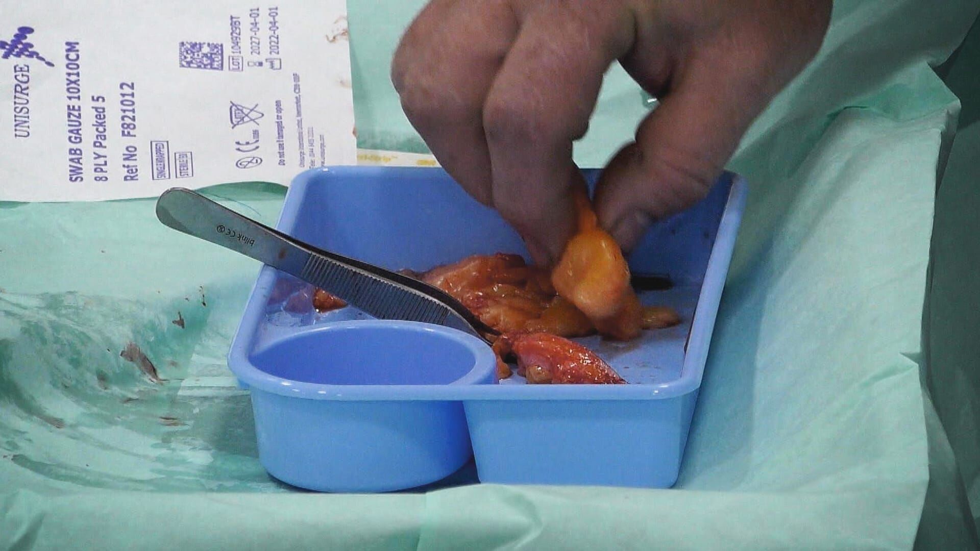 Hautnah – Dermatologen im Einsatz