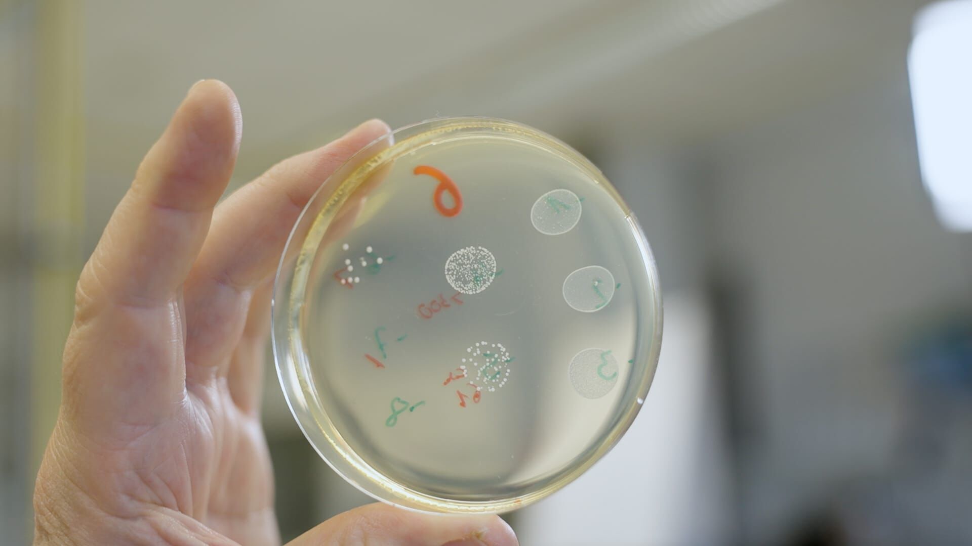 Fermentieren – Power für einen gesunden Darm