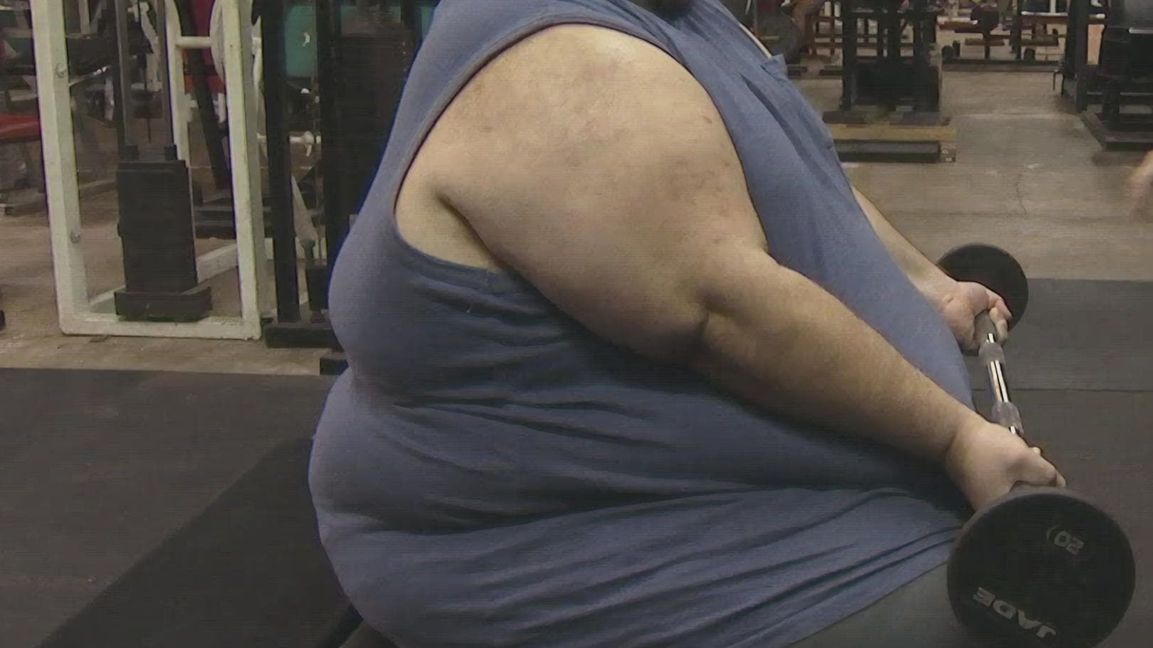 Mein Leben mit 300 kg