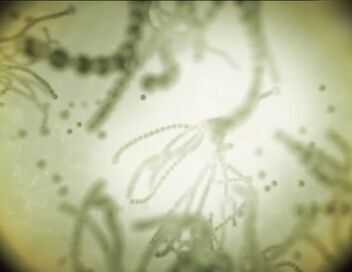 Pasteur et Koch : Un duel de géants dans le monde des microbes